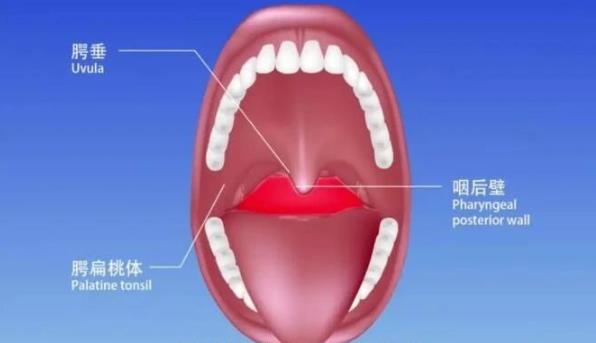 新型肺炎咽拭子采样标本如何处理？