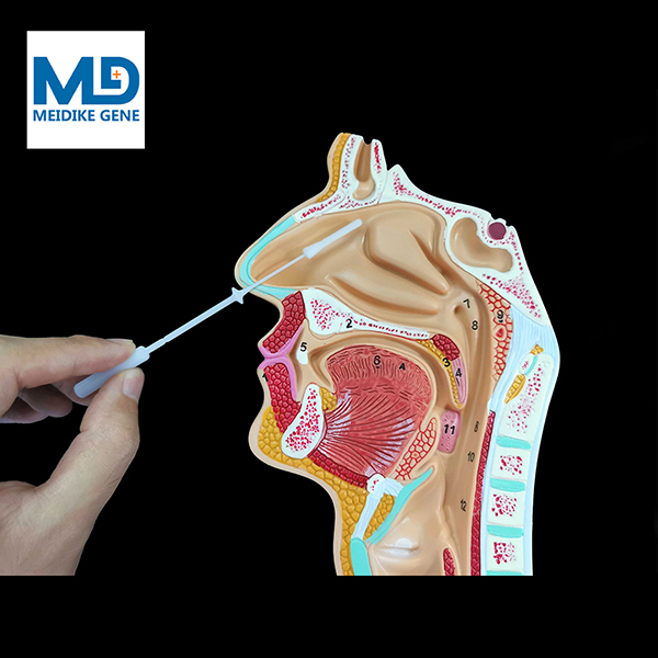 鼻咽拭子
